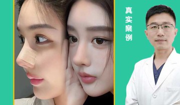 妈生鼻案例